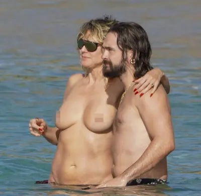 Reactions as American Model appears topless with her husband. 