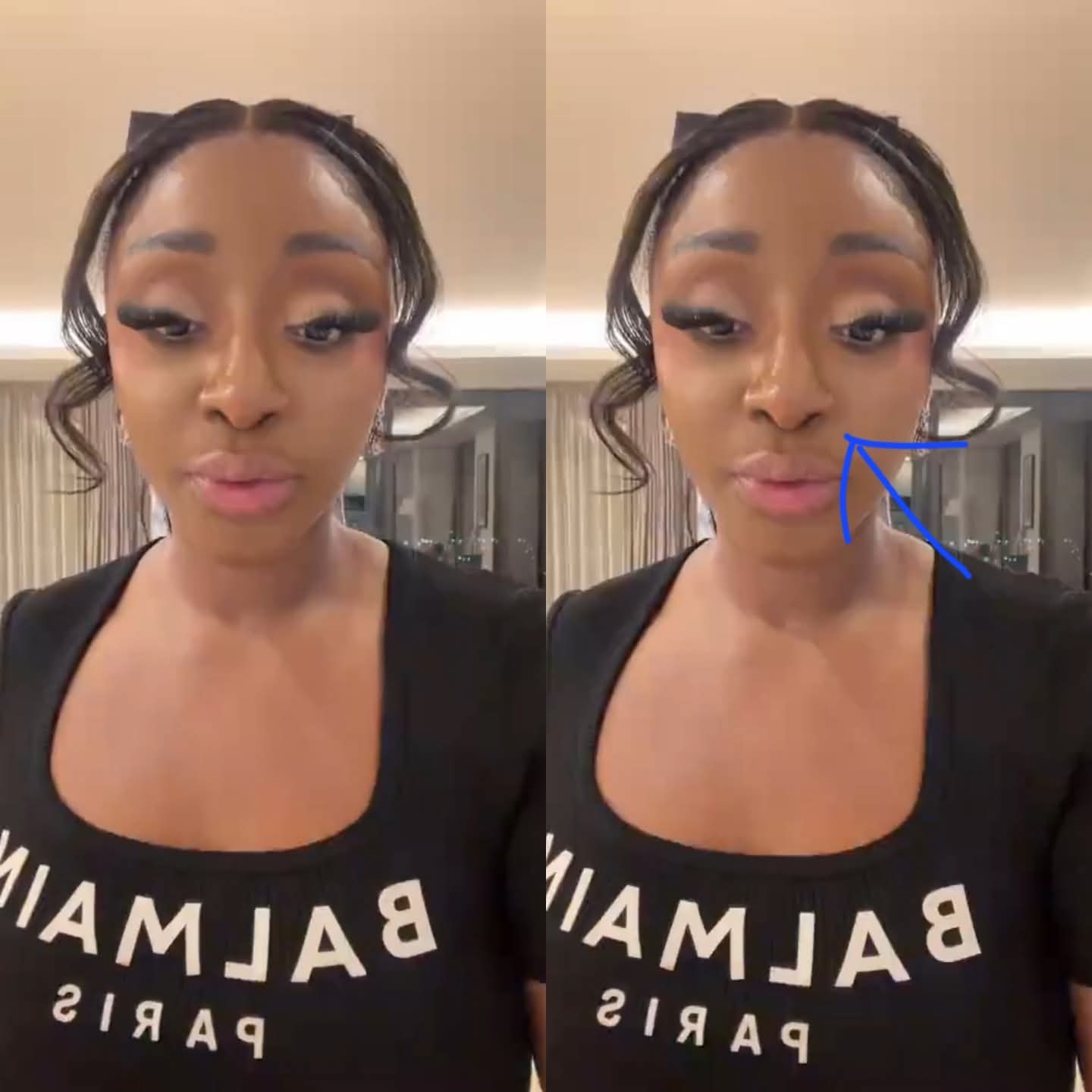 What happened to Actress Ini Edo$$@*!$$s nose ?
