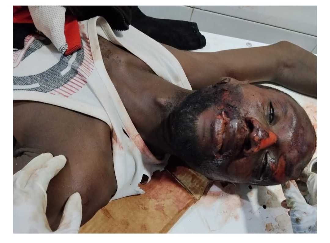 Sad: Unidentified man dies in Accident. 